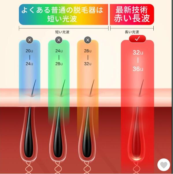 脱毛器 光脱毛器 フラッシュ IPL脱毛器 家庭用脱毛器 レディース